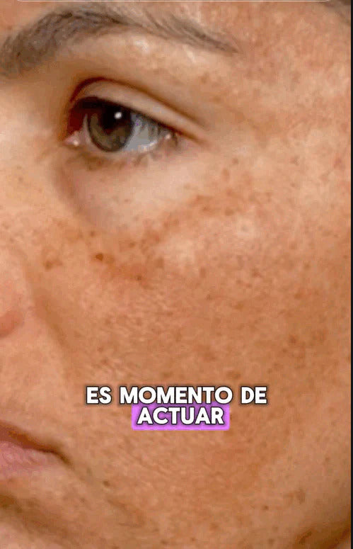 NUEVO SERUM FACIAL CON ARBUTINA ACLARADOR DE MANCHAS Y PECAS