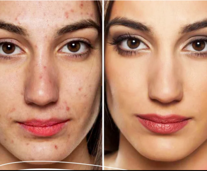 SERUM ACLARADOR DE MANCHAS Y PECAS