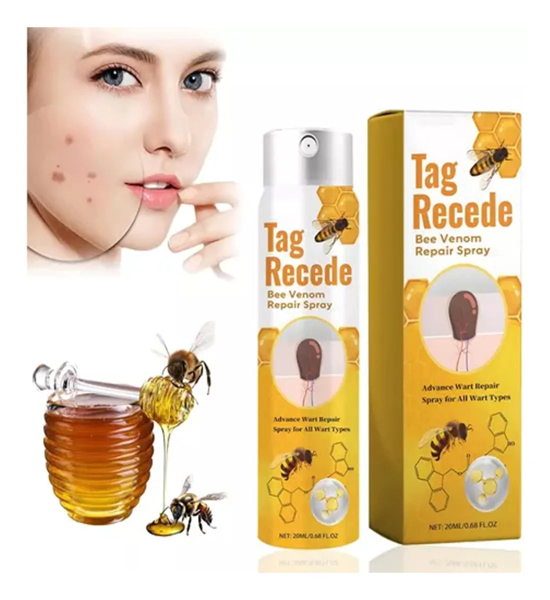 Spray Para Verrugas Con Veneno De Abejas