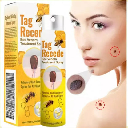Spray Para Verrugas Con Veneno De Abejas
