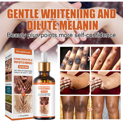 SERUM ACLARANTE CON NIACIMIDA